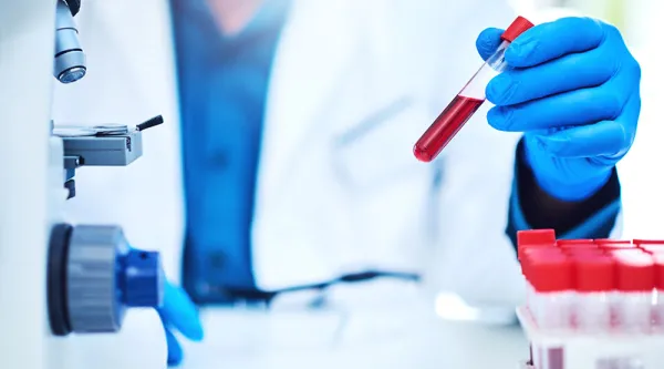 blood testing